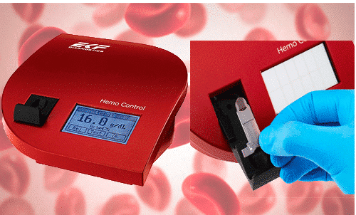 HemoControl analizador de sangre